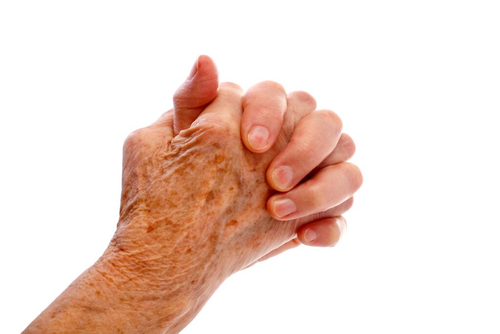 Wat zijn dat toch voor plekjes op je lijf? Als je ouder wordt, lijkt je huid een eigen leven te gaan leiden
