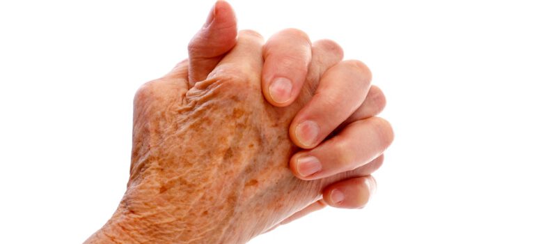 Wat zijn dat toch voor plekjes op je lijf? Als je ouder wordt, lijkt je huid een eigen leven te gaan leiden